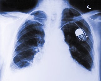 红桃视频网站入口：极限车手都市狂飙终极隐藏赛事解锁攻略全解析-2